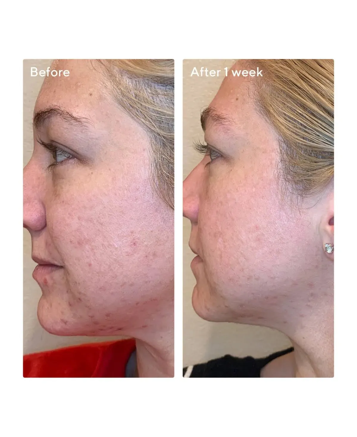 Murad Daily Clarifying Peel